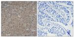 Phospho-SMAD3 (Ser425) Antibody in Immunohistochemistry (Paraffin) (IHC (P))