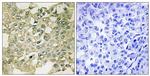 Phospho-PKMYT1 (Ser83) Antibody in Immunohistochemistry (Paraffin) (IHC (P))