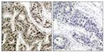 Phospho-NFkB p50 (Ser337) Antibody in Immunohistochemistry (Paraffin) (IHC (P))