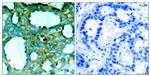 Phospho-PAK1 (Thr212) Antibody in Immunohistochemistry (Paraffin) (IHC (P))