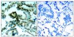 Phospho-PKC beta (Thr641) Antibody in Immunohistochemistry (Paraffin) (IHC (P))