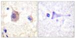 Phospho-PKC mu (Tyr463) Antibody in Immunohistochemistry (Paraffin) (IHC (P))