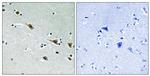 Phospho-MEK7 (Ser271) Antibody in Immunohistochemistry (Paraffin) (IHC (P))