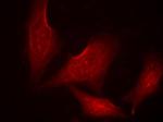 Phospho-NFkB p65 (Ser311) Antibody in Immunocytochemistry (ICC/IF)