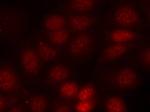 Phospho-p70 S6 Kinase (Thr421) Antibody in Immunocytochemistry (ICC/IF)