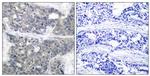 Phospho-p70 S6 Kinase (Thr421) Antibody in Immunohistochemistry (Paraffin) (IHC (P))