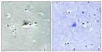 Phospho-Claudin 5 (Tyr217) Antibody in Immunohistochemistry (Paraffin) (IHC (P))