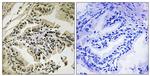 Phospho-PERK (Thr982) Antibody in Immunohistochemistry (Paraffin) (IHC (P))