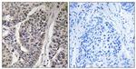 Phospho-p130Cas (Tyr410) Antibody in Immunohistochemistry (Paraffin) (IHC (P))