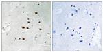 Phospho-ITCH (Tyr420) Antibody in Immunohistochemistry (Paraffin) (IHC (P))