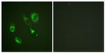 Phospho-EphA2/EphA3/EphA4 (Tyr588, Tyr596) Antibody in Immunocytochemistry (ICC/IF)