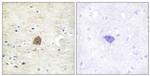 Phospho-CaMKII alpha/beta/delta (Thr305) Antibody in Immunohistochemistry (Paraffin) (IHC (P))