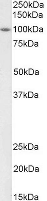 BMP1 Antibody in Western Blot (WB)