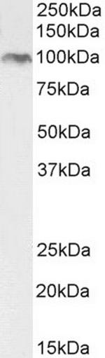 BMP1 Antibody in Western Blot (WB)