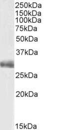 FGF5 Antibody in Western Blot (WB)