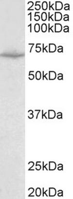 SLC6A8 Antibody in Western Blot (WB)