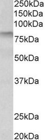 TGM3 Antibody in Western Blot (WB)