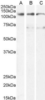 OSMR Antibody in Western Blot (WB)