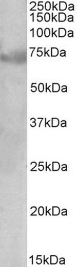 DMTF1 Isoform 1 Antibody in Western Blot (WB)