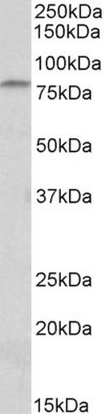 CD97 Antibody in Western Blot (WB)