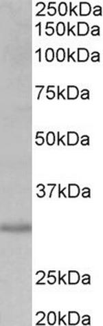 CRLS1 Antibody in Western Blot (WB)