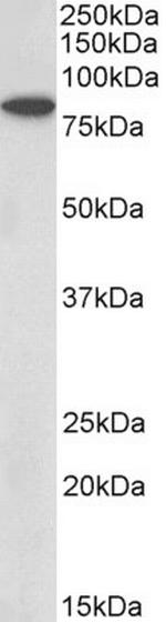 BBS7 Antibody in Western Blot (WB)