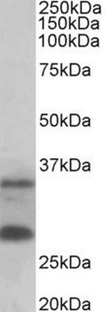 C16orf57 Antibody in Western Blot (WB)