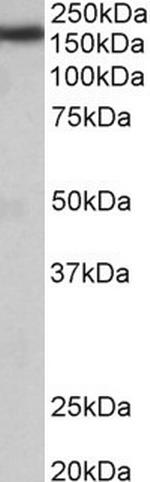 ZCCHC11 Antibody in Western Blot (WB)