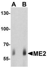 ME2 Antibody in Western Blot (WB)