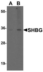 SHBG Antibody in Western Blot (WB)