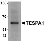 TESPA1 Antibody in Western Blot (WB)