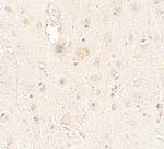 ULK3 Antibody in Immunohistochemistry (Paraffin) (IHC (P))