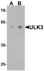 ULK3 Antibody in Western Blot (WB)