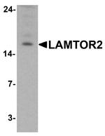 LAMTOR2 Antibody in Western Blot (WB)