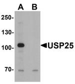 USP25 Antibody in Western Blot (WB)