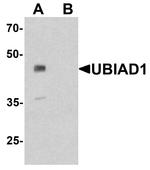 UBIAD1 Antibody in Western Blot (WB)
