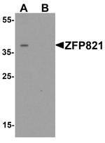 ZNF821 Antibody in Western Blot (WB)