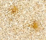 DOCK8 Antibody in Immunohistochemistry (Paraffin) (IHC (P))