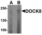 DOCK8 Antibody in Western Blot (WB)