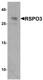 RSPO3 Antibody in Western Blot (WB)