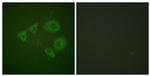 Phospho-TrkB (Tyr705) Antibody in Immunocytochemistry (ICC/IF)