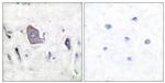 Phospho-TrkB (Tyr705) Antibody in Immunohistochemistry (Paraffin) (IHC (P))