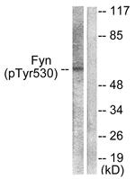 Phospho-Fyn (Tyr530) Antibody in Western Blot (WB)