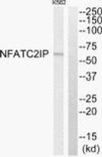 NFATC2IP Antibody in Western Blot (WB)