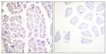 Phospho-IKK alpha/beta (Ser180, Ser181) Antibody in Immunohistochemistry (Paraffin) (IHC (P))