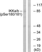 Phospho-IKK alpha/beta (Ser180, Ser181) Antibody in Western Blot (WB)