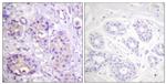 Phospho-IKK beta (Tyr199) Antibody in Immunohistochemistry (Paraffin) (IHC (P))