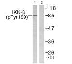 Phospho-IKK beta (Tyr199) Antibody in Western Blot (WB)