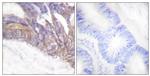 Phospho-LAT (Tyr191) Antibody in Immunohistochemistry (Paraffin) (IHC (P))