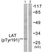 Phospho-LAT (Tyr191) Antibody in Western Blot (WB)